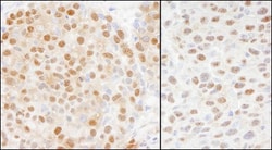 Cullin 4a Antibody, Novus Biologicals 0.1 mL | Buy Online | Novus Biologicals | Fisher Scientific